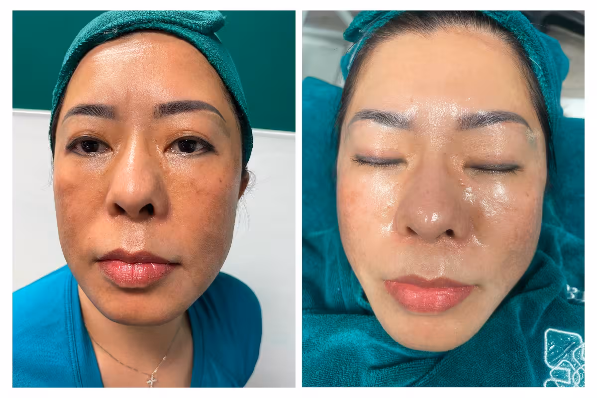 Chăm Sóc Da & Điều Trị 1