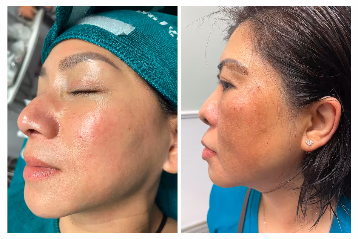 Chăm Sóc Da & Điều Trị 2