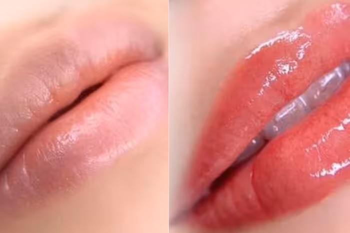 LIP TREATMENTS