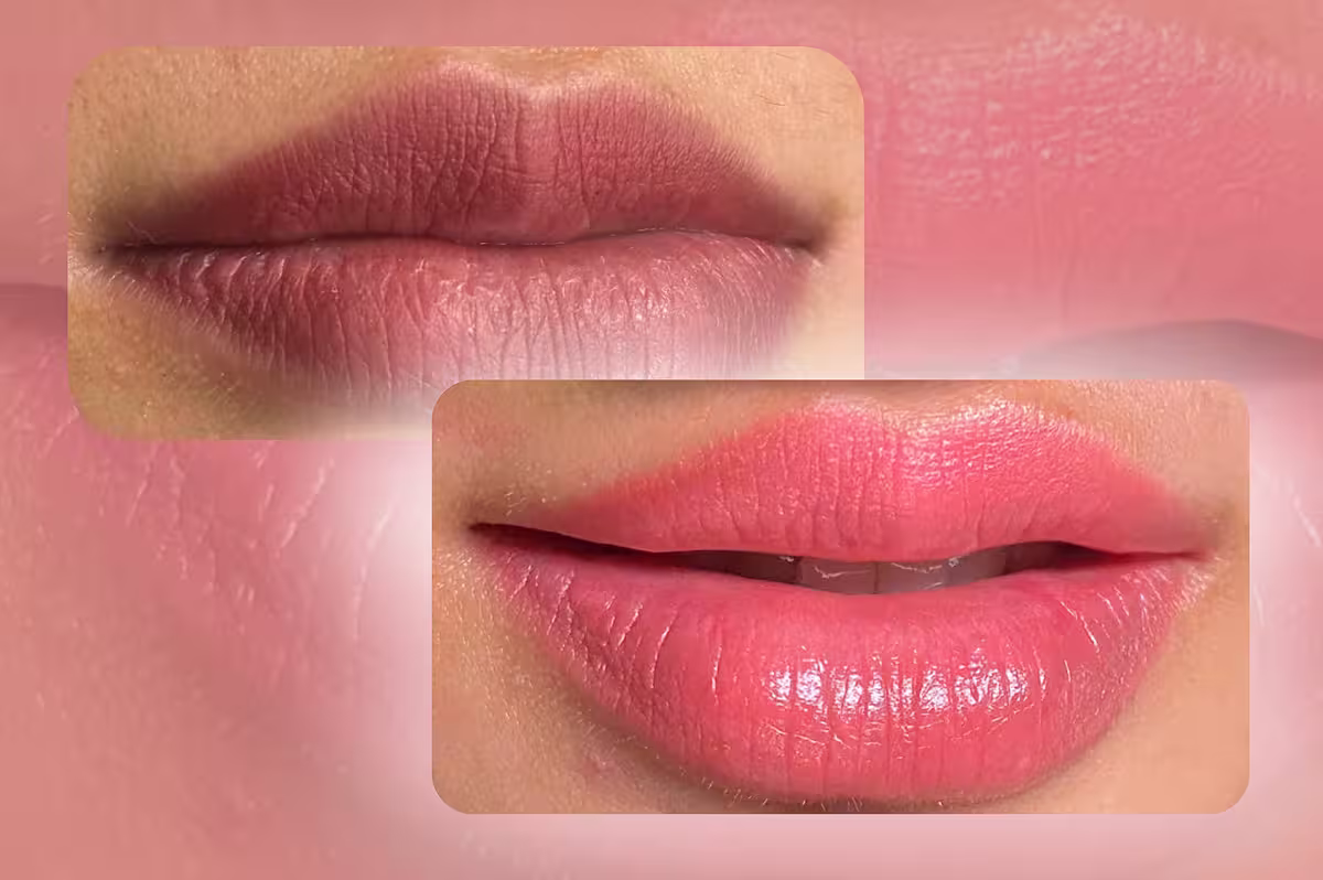 DARK LIPS REMOVER